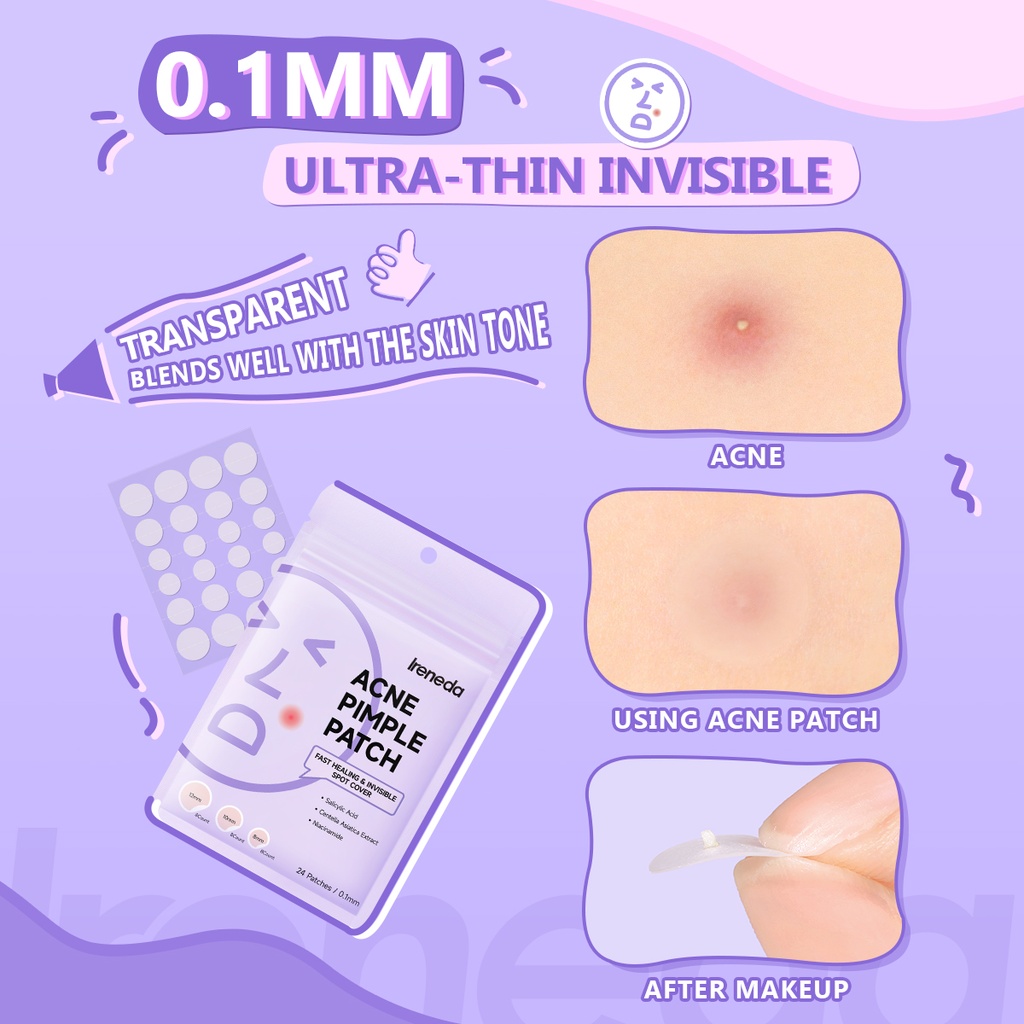 IRM02 - Ireneda ACNE Pimple Patch